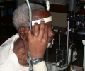 rombo-cataract-after-surgery